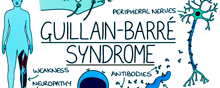What is Guillain-Barre Syndrome, Signs & Symptoms, Causes, Diagnosis, and Treatment?