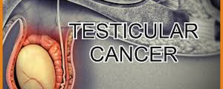 Testicular Cancer: How to Prevent It or How You Can Prevent Testicular Cancer